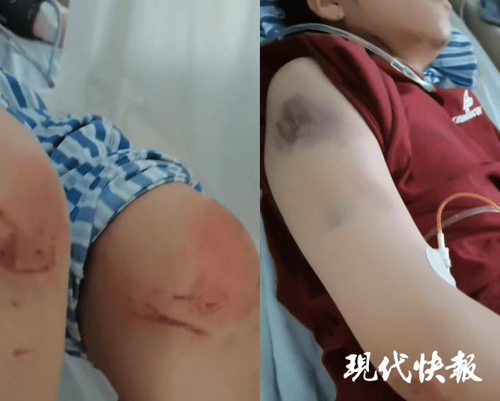 皇冠信用网最新地址_石家庄被家暴女子驾车逃跑致丈夫身亡皇冠信用网最新地址,一审以故意杀人罪获刑11年