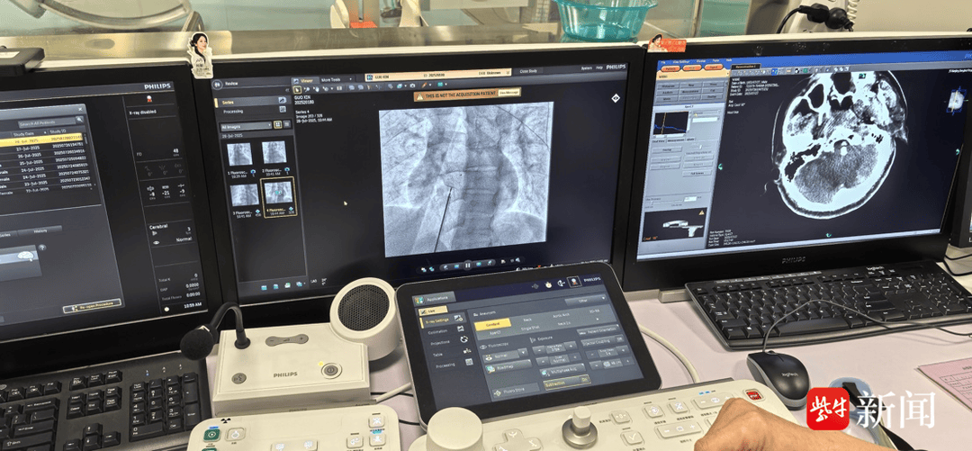 如何代理皇冠信用網_36岁青年男性突发脑梗死如何代理皇冠信用網,病因竟是心脏上有个“洞”!