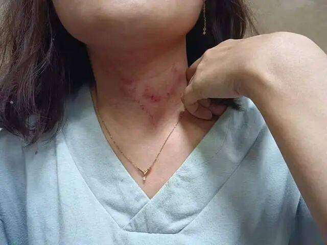 皇冠信用网正网
_一男子凌晨听到两声呼救皇冠信用网正网
,循声发现一女子在奔驰车外被白衣男勒昏!受害者:是受朋友之托借钱给白衣男,凌晨被骗至偏僻处遭非礼!