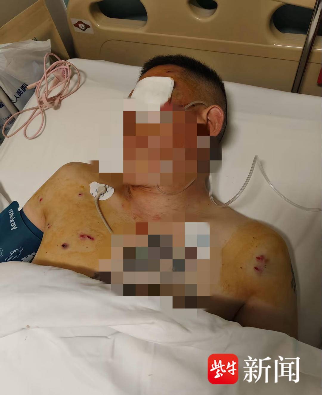 排球_紫牛头条｜男子取款170万在银行门口遭抢劫致重伤排球，当事人认为银行保安未帮忙应担责